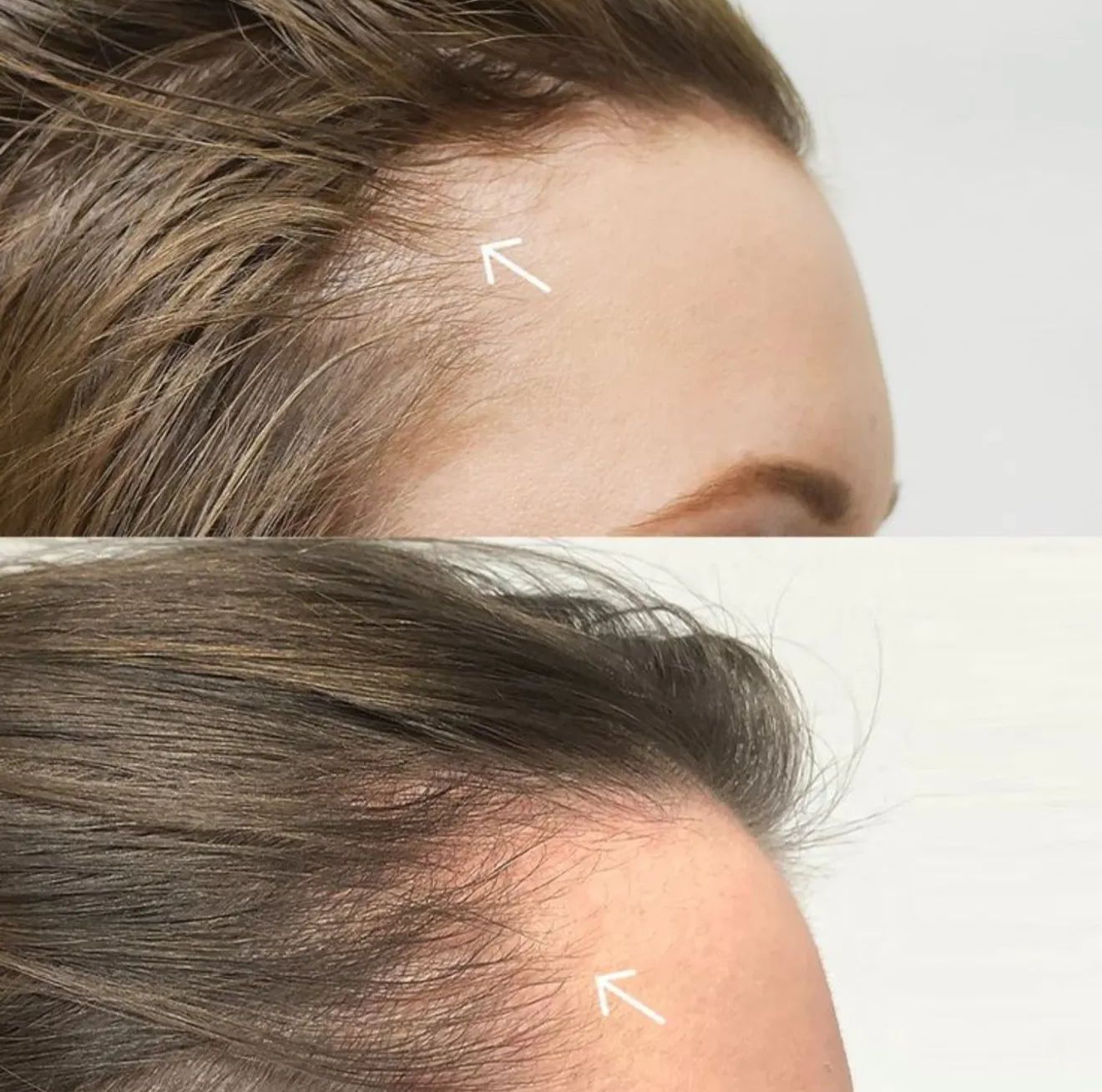 Résultat traitement 4