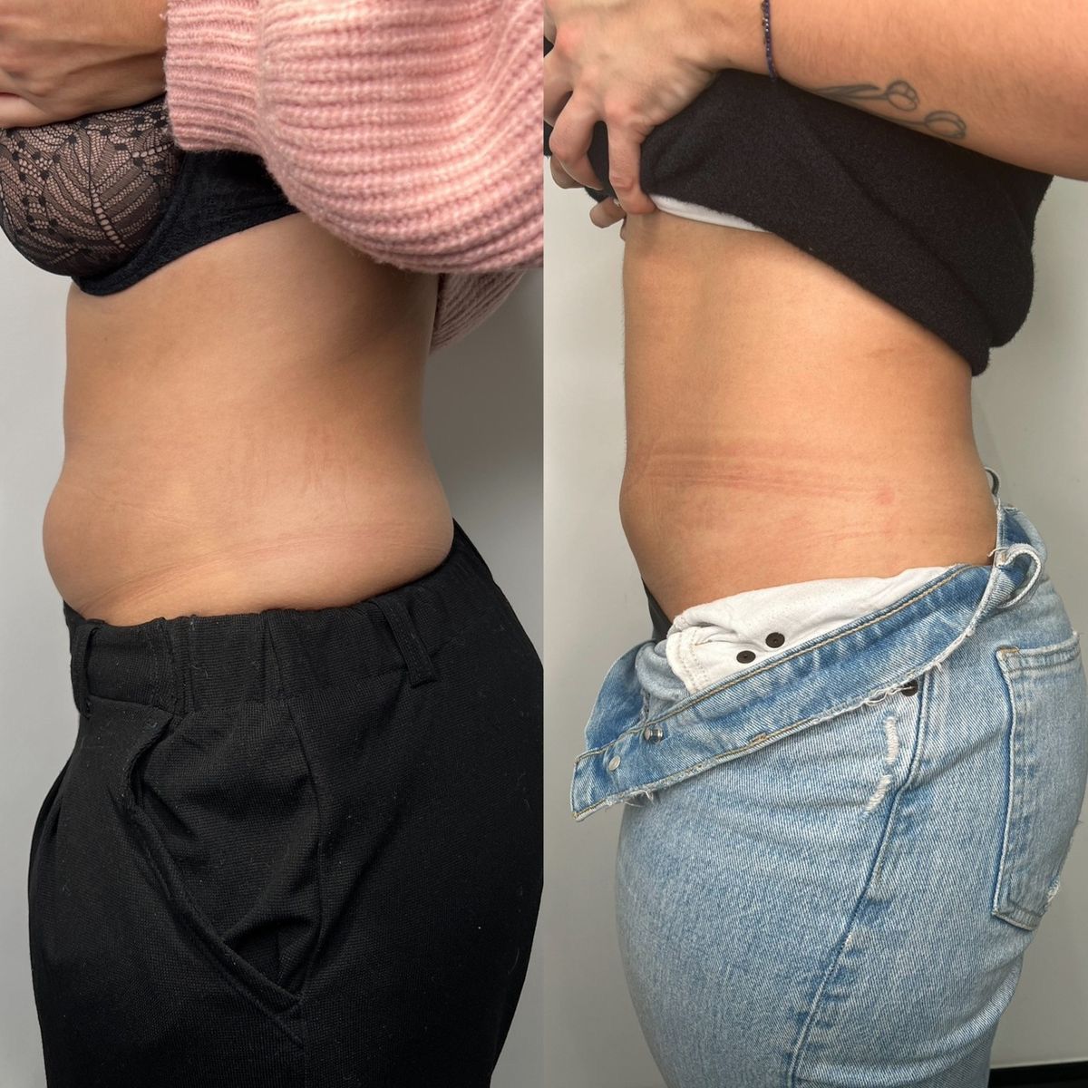 Résultat traitement 5