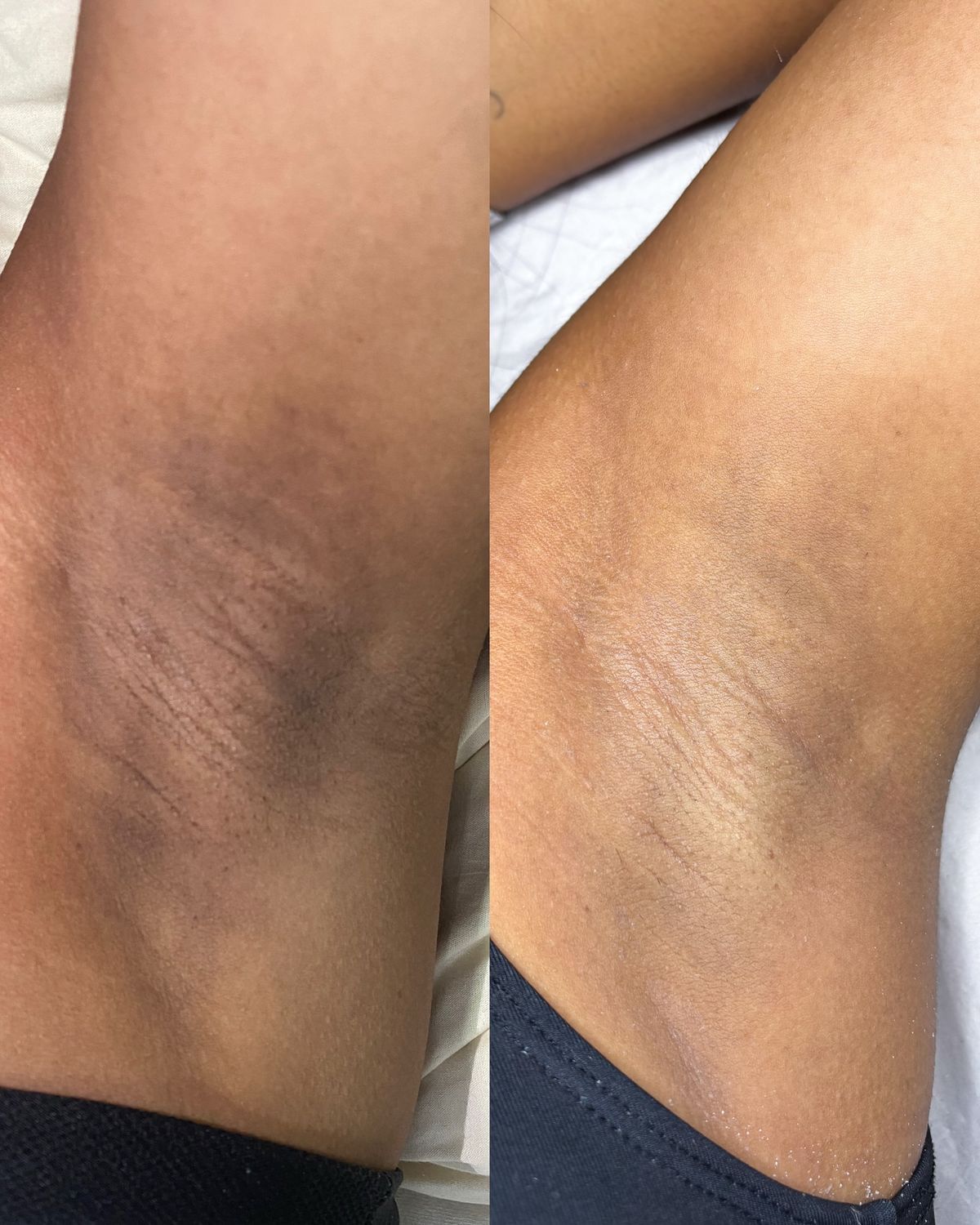 Résultat traitement 7