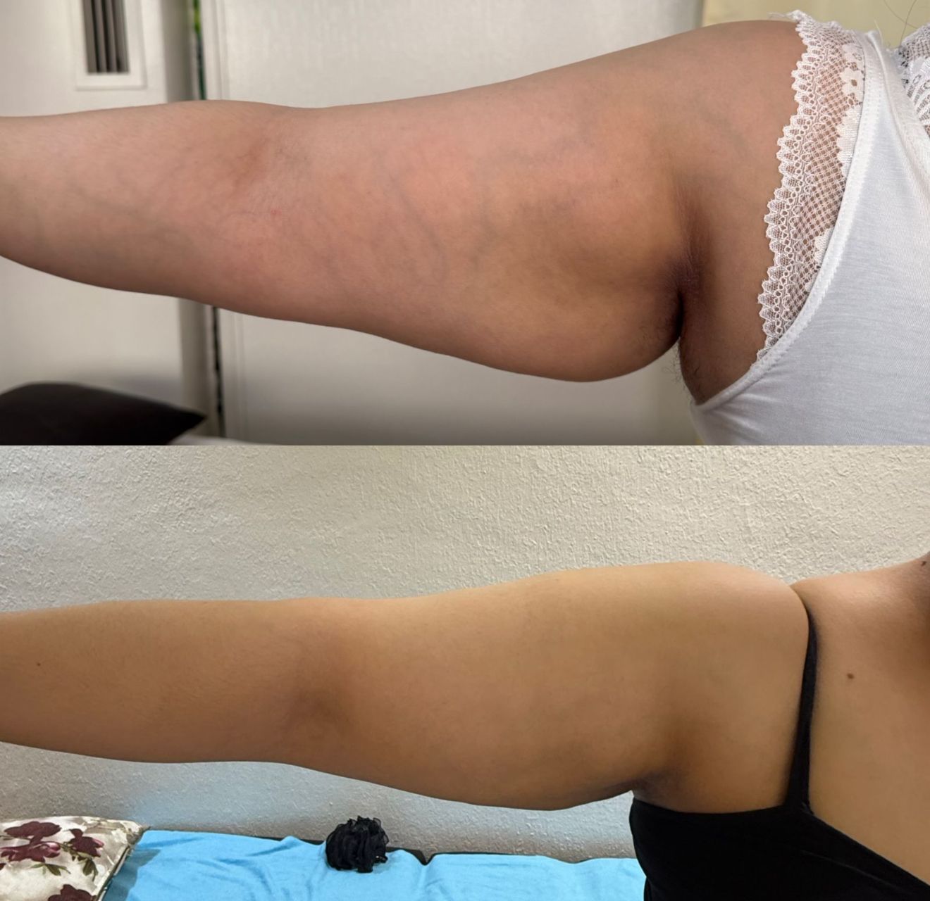 Résultat traitement 8