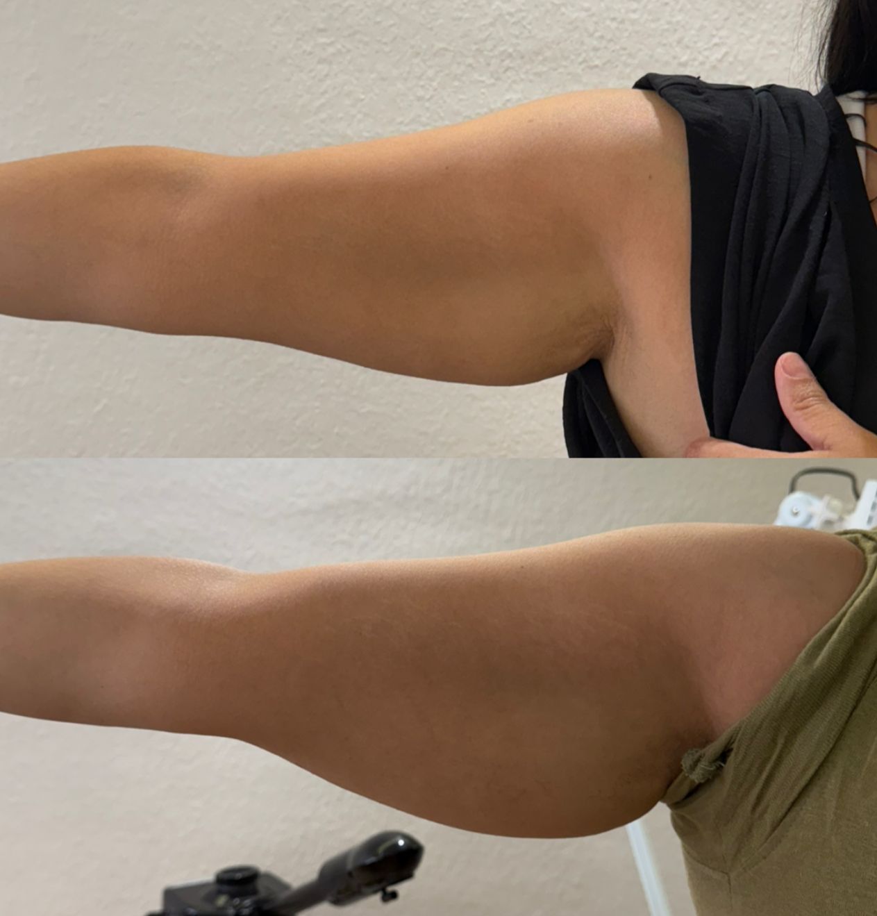 Résultat traitement 9