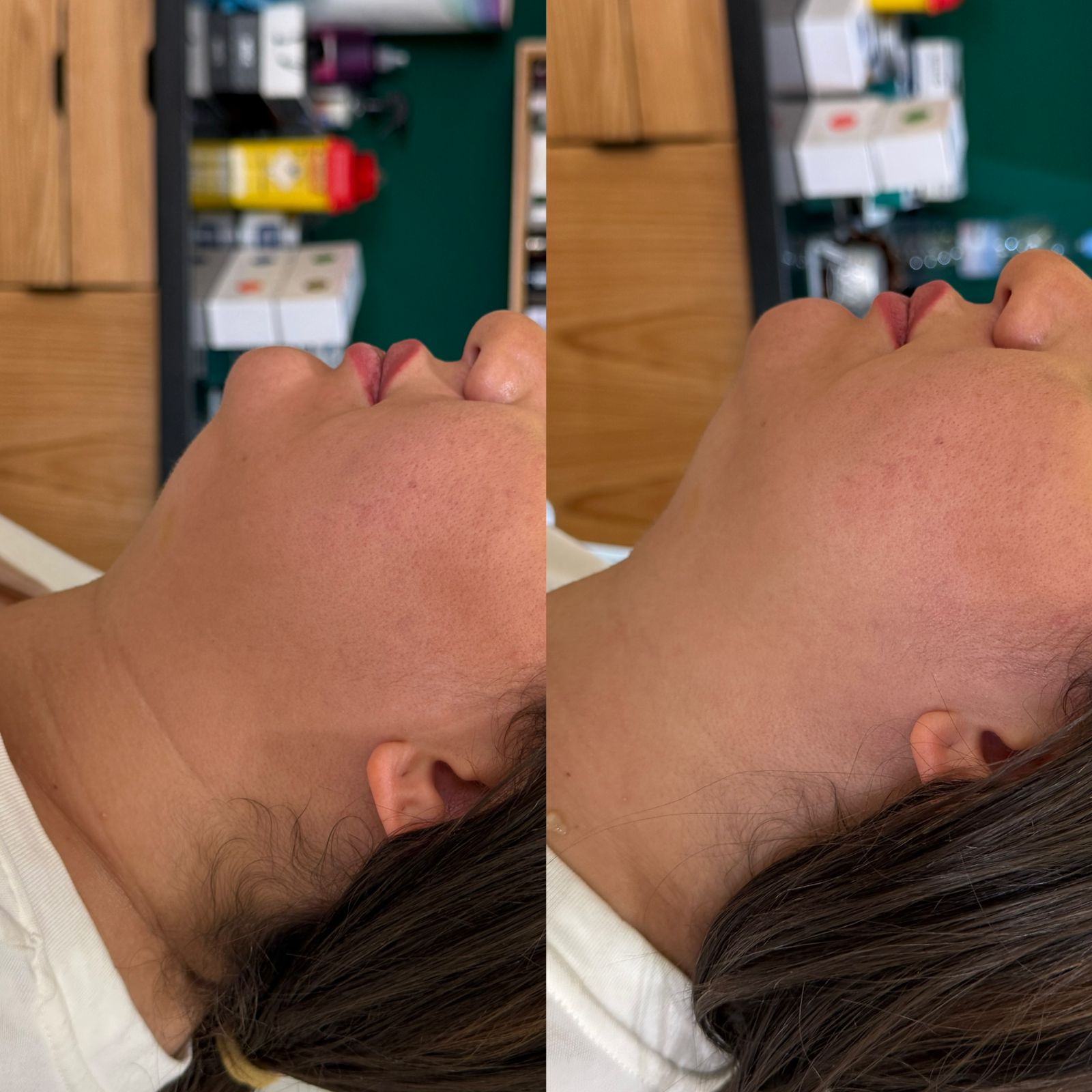 Résultat traitement 3