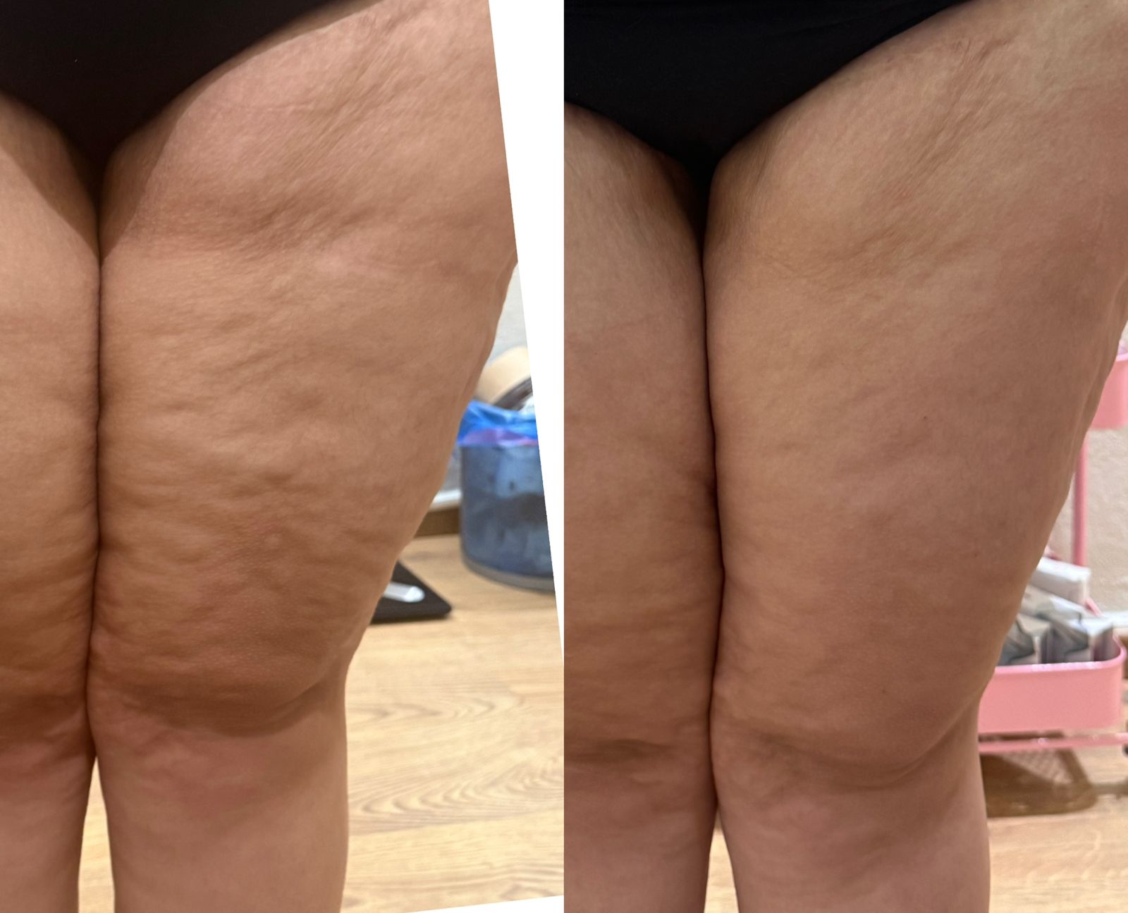 Résultat traitement 6